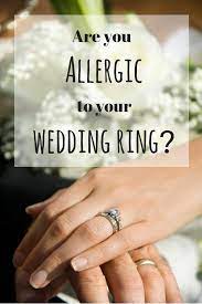 Are You Allergic To Your Wedding Ring Wedding Rings Allergy Treatment Rings