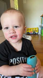 I try to share our allergy journey often because I know how stressful it  was when we started 7 years ago with karsen. It’s so helpful to hear others  journey and that you’re not alone! Kanaan has had a ...