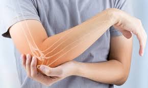 Medial epicondylitis is a lesion of the common flexor origin (cfo) on the medial epicondyle also golfer's elbow,often also called medial epicondylitis is defined as a pathologic condition that involves. Tennis Elbow Home Treatment Proliance Orthopedic