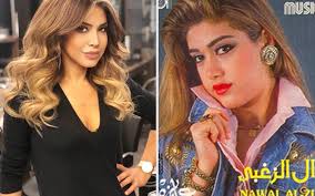 اسنان نوال الزغبي قبل وبعد الإبتسامة الهوليوودية. Ø§Ù„Ù…Ø´Ø§Ù‡ÙŠØ± Ù‚Ø¨Ù„ ÙˆØ¨Ø¹Ø¯ Ø§Ù„Ø¹Ù…Ù„ÙŠØ§Øª Ø§Ù„ØªØ¬Ù…ÙŠÙ„ÙŠØ© Ø­Ù„ÙˆØ©