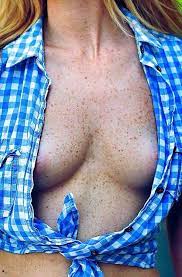 Freckled breasts