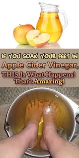 If You Soak Your Feet In Apple Cider Vinegar This Is What Happens That S Amazing Cider Vinegar Benefits Apple Cider Vinegar Benefits Natural Herbal Remedies