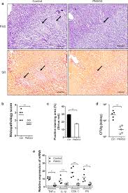 The complement factor 5a receptor 1 has a pathogenic role in chronic  inflammation and renal fibrosis in a murine model of chronic pyelonephritis 