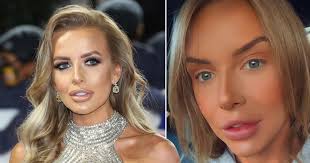 Love Island's Faye Winter nervous as she gets lip fillers dissolved
