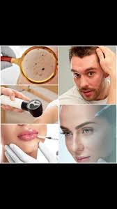 📲 Se atiende , 📕P O R CITAS:, Dermatóloga , Dra. Sonia Calles Batres.,  📲22 26 66 53 , ( Horarios hábiles , 9 a.m a 4 p.m), 📲70 85 28 91 , (  WhatsApp )., 🔸️Estamos en Nueva Ubicación. , Santa Elena. , ...