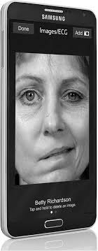 Stop Stroke: A Brief Report