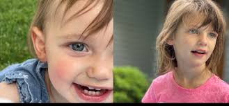 With Weekly Visits for Their 'Brain Juice,' Sisters Annabelle and Abigail  Navigate a Therapy for Batten Disease