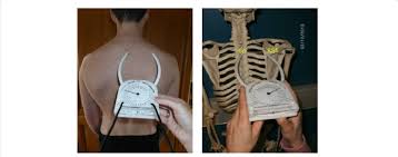 The superficial back muscles are situated underneath the skin and superficial fascia. Measurement Of The Distance Between The Root Of The Spine Of The Download Scientific Diagram