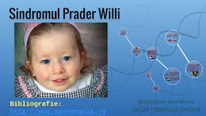 Dadurch entsteht unter anderem ein mangel des wichtigen wachstumshormons. Sindromul Prader Willi By Ana Maria Brandusan On Prezi Next