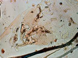 Image result for Dust mite