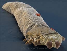 Image result for Demodex brevis
