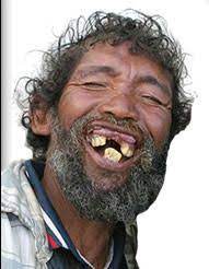 Find the perfect women with no teeth stock illustrations from getty images. Man With No Teeth Pictures Teethwalls