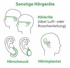 Horgerate Arten Ubersicht Welche Horgerate Gibt Es