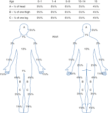 Burn Injury Rule Of Nines Springerlink