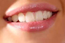 Dazu zählt natürlich auch ein ästhetisches und natürliches lächeln. Aesthetics Cosmetic Dentistry