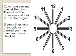 Astigmatism Hct Ii Astigmatism An Abnormal Shape Or