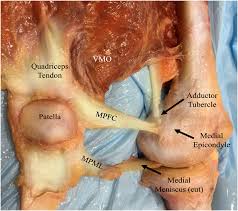 Image result for Patellar Tilt Test