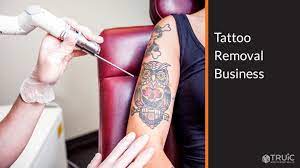 How To Start A Tattoo Removal Business | Truic