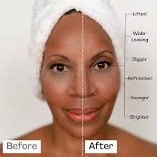 Amazon.Com: Ultra Invisible Double Eyelid Tapes Lift Stickers - Instant Eye  Lift Without Surgery, Medical Grade Latex Free Hypoallergenic Fiber,  Perfect For Saggy, Hooded, Droopy, Uneven, Mono-Eyelids : Beauty & Personal  Care