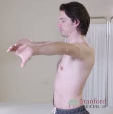 Image result for Shoulder Instability Exam