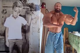 Bodybuilder Who Injects Oil Into Muscles To Bulk Up Shares Before And After Photos Synthol is a muscle site enhancement oil used to enhance the appearance of a specific muscle. injects oil into muscles