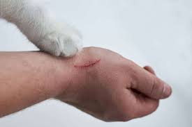Image result for Cat Bite