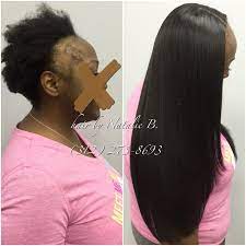 No Closure Used First Time Client Of Mine Came To Me Suffering From Hair Loss Due To Traction Alopecia Sh Black Women Hair Loss Hair Loss Problem Hair Loss