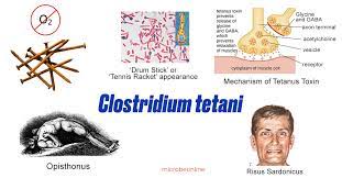 Clostridium tetani es una bacteria letal 1 formadora de esporas y anaerobia.encontrada en los hogares del ser humano y en la comida, en forma de esporas o como parásito en el tracto gastrointestinal de animales, es causante de infecciones muy graves en los humanos, y provoca la enfermedad del tétanos, generalizado: Clostridium Tetani Properties Pathogenesis Lab Diagnosis Microbe Online