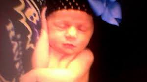 Couple Deceived By Woman Pretending To Be Pregnant Will Never Forgive Her Abc News