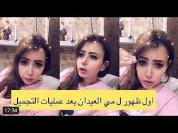 حرب كلامية بين الدكتورة خلود ومي العيدان بعد كشف الأولى سبب إجرائها عملية التجميل! Ù…ÙŠ Ø§Ù„Ø¹ÙŠØ¯Ø§Ù† ÙÙŠ Ø§ÙˆÙ„ Ø¸Ù‡ÙˆØ± Ù„Ù‡Ø§ Ø¨Ø¹Ø¯ Ø¹Ù…Ù„ÙŠØ§Øª Ø§Ù„ØªØ¬Ù…ÙŠÙ„ Youtube