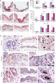 We hypothesized that microwounds formed by repeated microneedle stimulation could induce hair growth. Exploring The Hair Growth Wound Healing Connection Anagen Phase Promotes Wound Re Epithelialization Sciencedirect