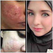 62 likes · 3 talking about this. Cinderella Miracle World Kurus Putih Cantik Semulajadi Produk Kurus Putih Paling Berkesan Cinderella