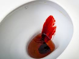 According to the colon cancer alliance, the risk of developing colon cancer is one in 20. Rectal Bleeding Archives Carlisle Digestive Disease Associates