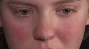 Topeka teen describes attack after video goes viral