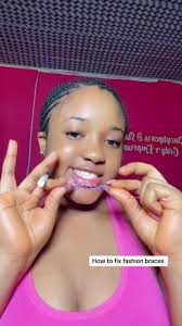 We sell amd fix fashion braces in enugu & please teeth braces we sell amd  fix are for fashionable purpose only we have different colors of braces  #fashionbraces #bracesoff #bracescolors #braces #brac ...