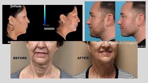 With tools for job search, resumes, company reviews and more, we're with you every step of … Unfiltered Dermatology Procedures To Have You Camera Ready Abc7 San Francisco