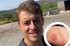 Blacko: Man's warning after contracting Lyme disease