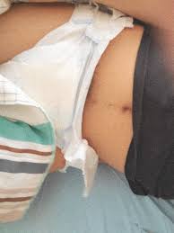 I dont own thies picks unless other wises stated please reblog. Tumblr Teen Diaper Bbtblrnude