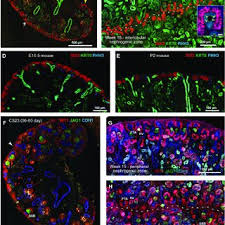 PDF) Conserved and Divergent Features of Human and Mouse Kidney  Organogenesis