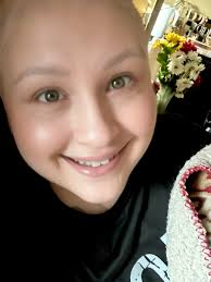 Managing multiple sclerosis symptoms