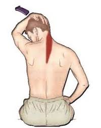 Pin On Headache Relief Trigger Points