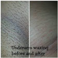 With all the mixed signals coming from bloggers and specialists on. Waxing Before And After With Nufree Wax Nufree Wax Waxing Underarm Waxing