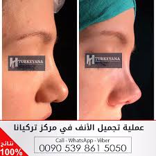 Pin On Plastic Surgery