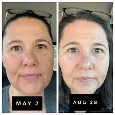 How can i rid from this? day by day it's going worst 🥺