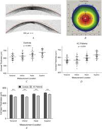 Corneal Pachymetry Using The Rotating Scheimpflug Camera A