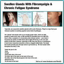 Swollen Glands With Fibromyalgia Fibromyalgia Awareness Fibromyalgia Chronic Fatigue Syndrome