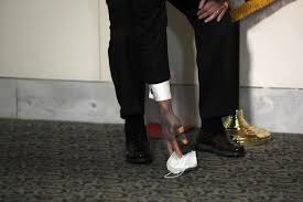 Mitch mcconnell is the senior senator of kentucky. Mitch Mcconnell S Hand Discolored He Says He S Healthy
