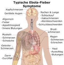 Like ebola, marburg virus disease can cause severe hemorrhaging that leads to shock, organ failure, or death. Ebola Ursachen Symptome Behandlung Medlexi De