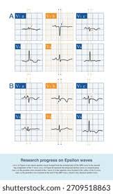 Image result for Epsilon Wave