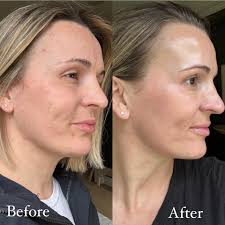 The most gorgeous glow up